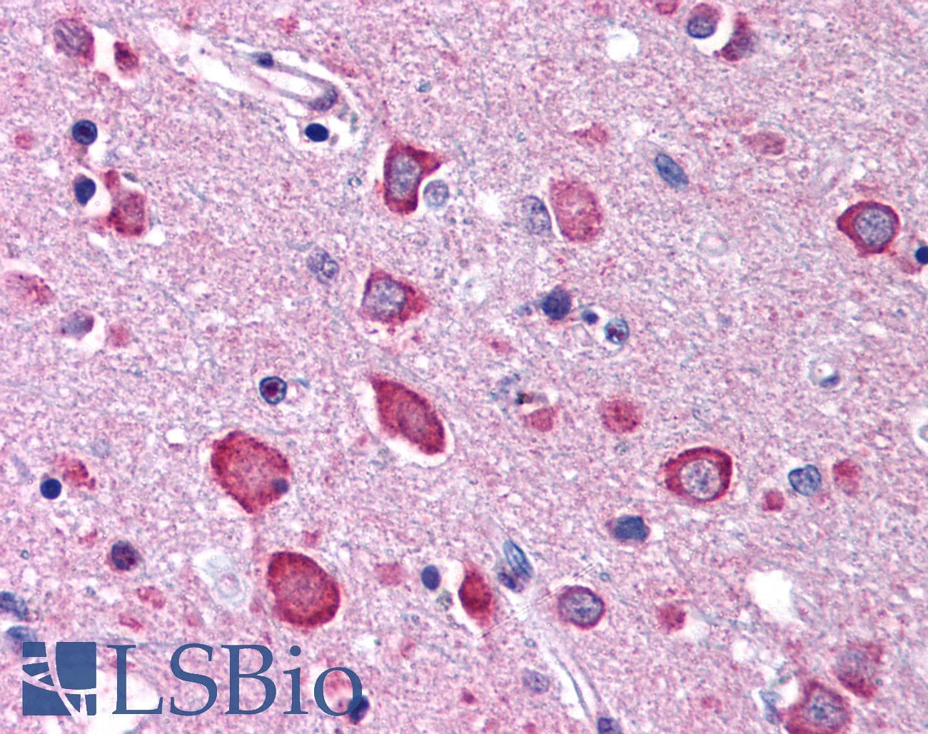 IHC-plus™ Polyclonal Rabbit anti-Human KIAA1811 / BRSK1 Antibody (IHC, IF, WB)