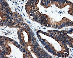 SRR / Serine Racemase Antibody (clone OTI1D7)