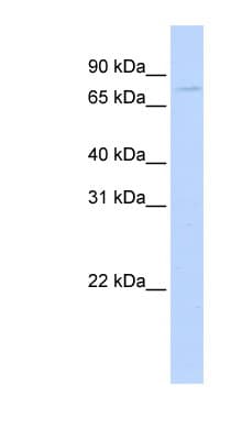 APP / Beta Amyloid Precursor Antibody (aa324-373)