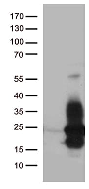 Monoclonal Mouse anti-Human HBEGF / HB EGF Antibody (clone OTI6B9, Carrier-free, aa20-208, WB)