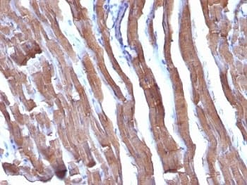 Muscle Actin Antibody (clone HHF35 + MSA/953)