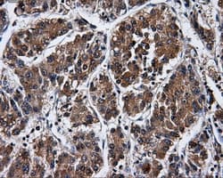 PME-1 / PPME1 Antibody (clone OTI6H5)