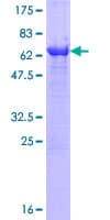 Human NME7 Protein (Recombinant GST)