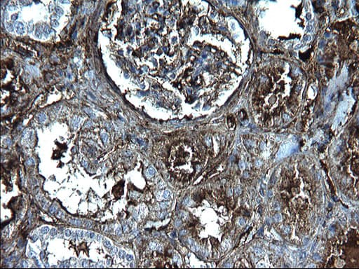 FGG / Fibrinogen Gamma Antibody (clone OTI2D2)