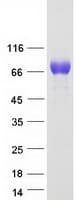 Human TYRP1 / gp75 Protein (Recombinant Myc-DDK (Flag))