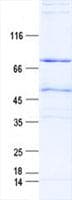Human ZNF76 Protein (Recombinant His, N-Terminal)