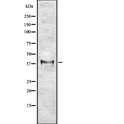 Polyclonal Rabbit anti-Human ETV2 Antibody (aa148-174, WB)