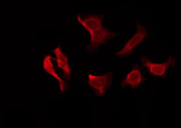 JCG1 / OR5P3 Antibody