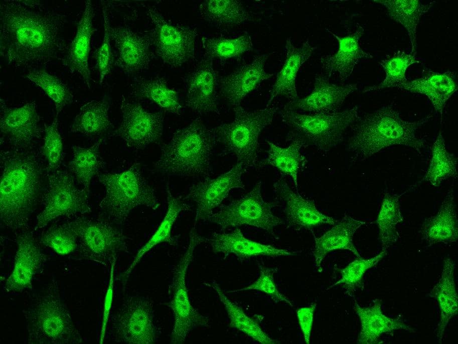 Polyclonal Rabbit anti-Human STAT6 Antibody (Preservative Free, IF)