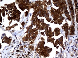 NME1 / NM23 Antibody (clone OTI2H10)