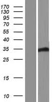 FBXO22 Protein (Over-Expression Lysate Myc-DDK (Flag))