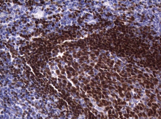 PAX5 Antibody (clone OTI1H5, Carrier-free)
