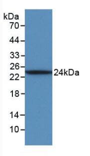 IL6 / Interleukin 6 Antibody (aa30-208)