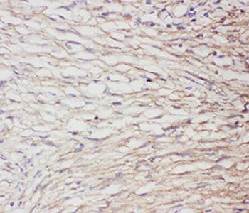 Polyclonal Rabbit anti-Human GFAP Antibody (IHC, WB)