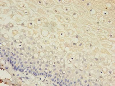 Polyclonal Rabbit anti-Human GJB3 / CX31 / Connexin 31 Antibody (aa211-270, IHC, WB)