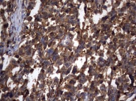 Monoclonal Mouse anti-Human NME1 / NM23 Antibody (clone OTI6G10, IHC, WB)