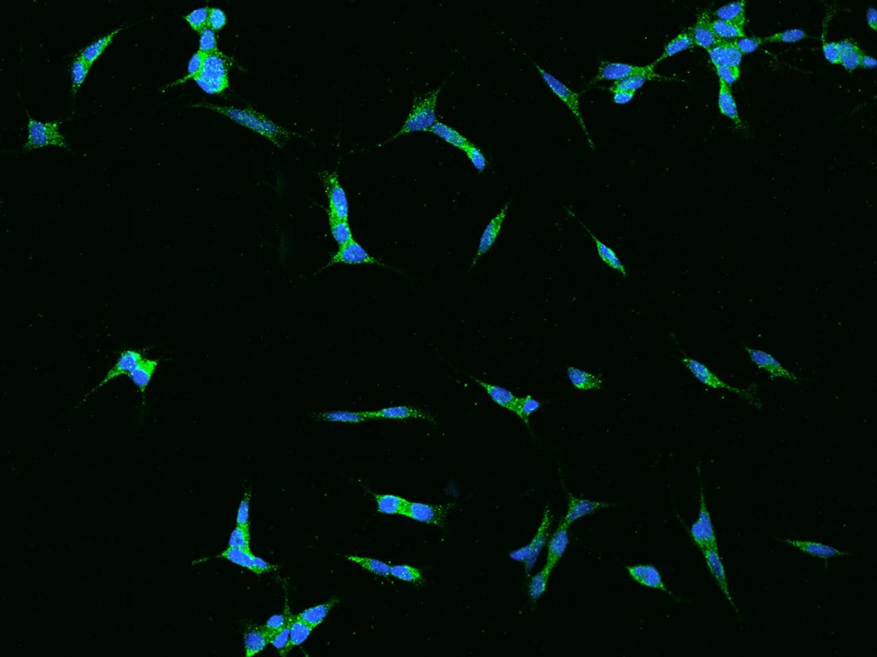 ADCYAP1R1 / PAC1 Receptor Antibody
