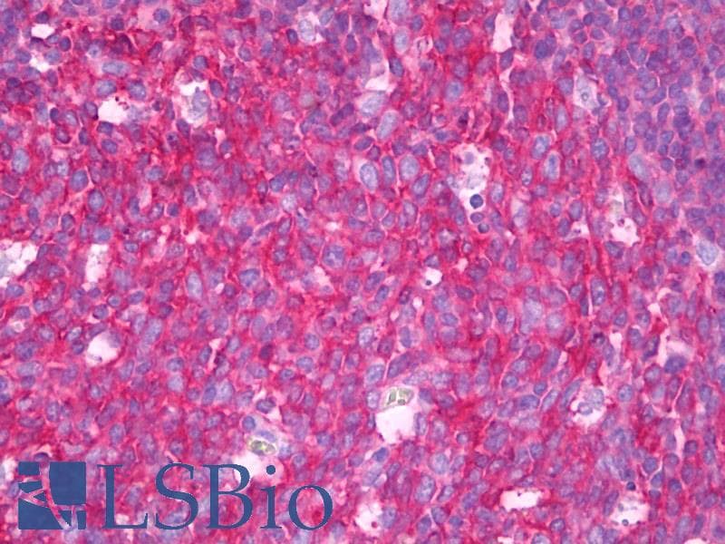 IHC-plus™ SNAP23 / SNAP-23 Antibody