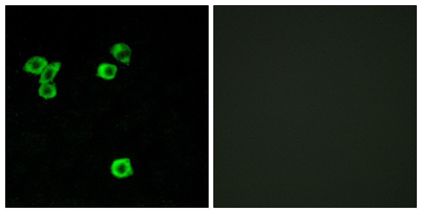 Polyclonal Rabbit anti-Human RPS6KC1 Antibody (IF, WB)
