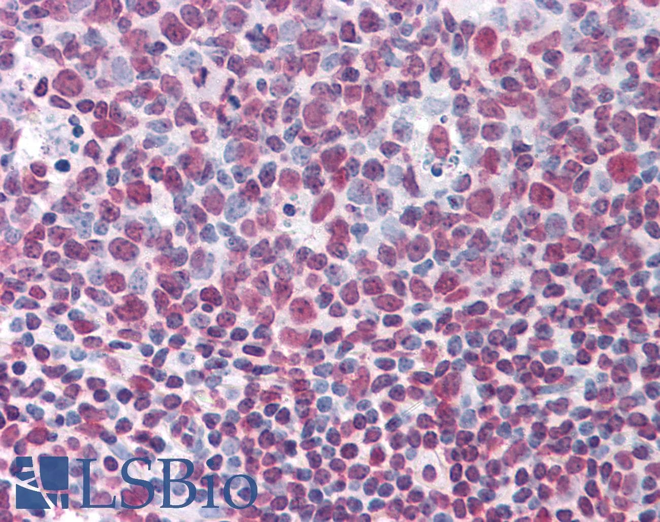 IHC-plus™ Monoclonal Mouse anti-Human KHSRP / FBP2 Antibody (clone 4C10, IHC, WB)