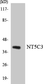 Polyclonal Rabbit anti-Human NT5C3A Antibody (aa36-85, IHC, WB)