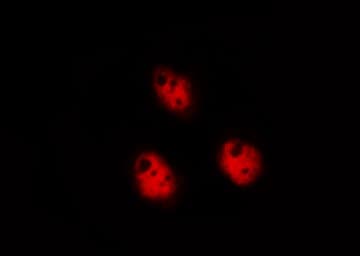 Polyclonal Rabbit anti-Human DDIT3 / CHOP Antibody (IHC, IF, WB)