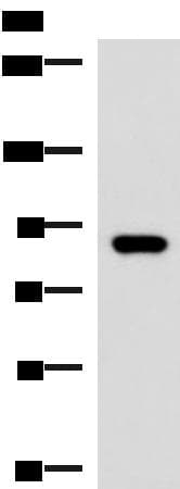 Polyclonal Rabbit anti-Human ABCB5 Antibody (WB)