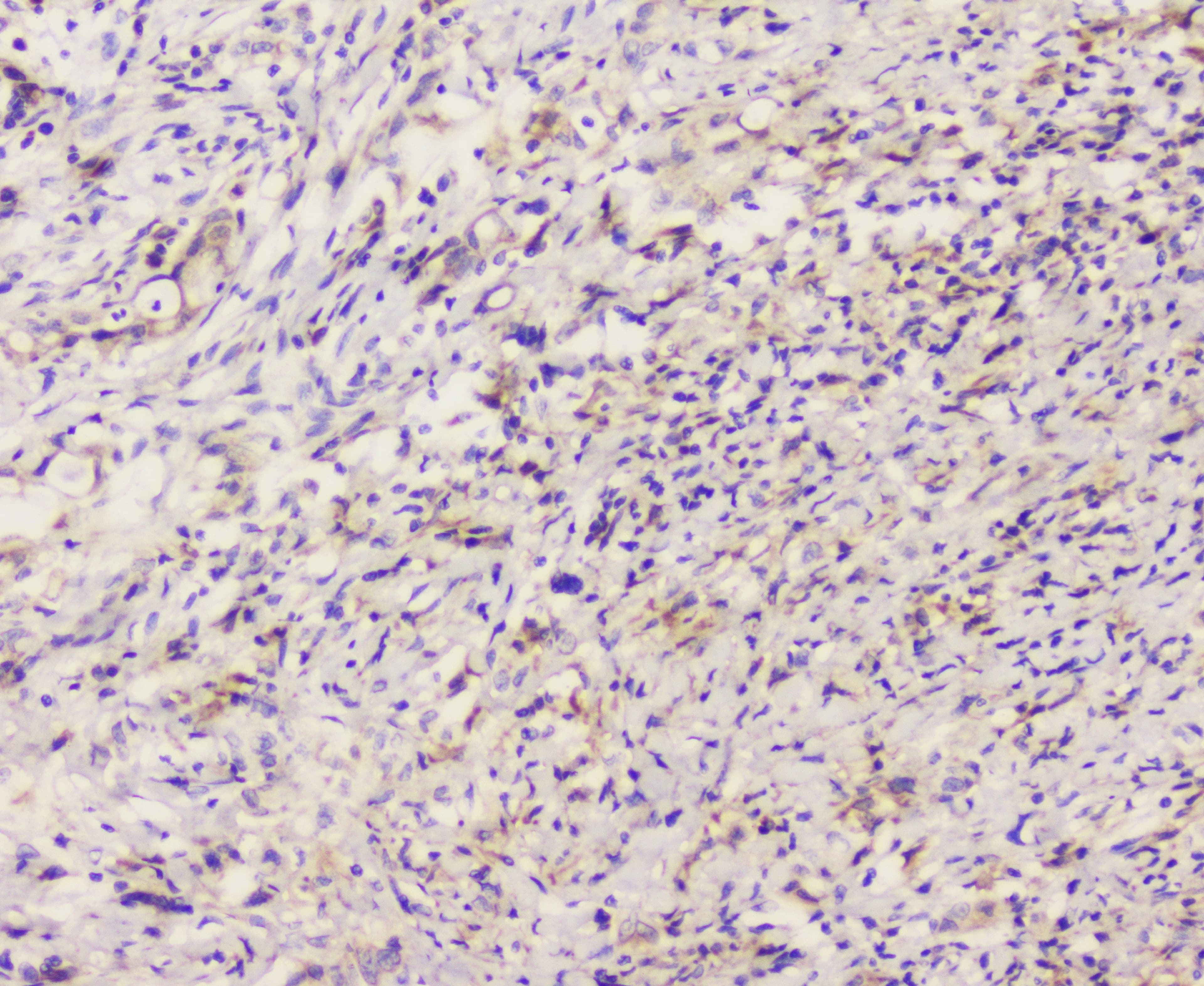 Polyclonal Rabbit anti-Human EML4 Antibody (IHC, WB)