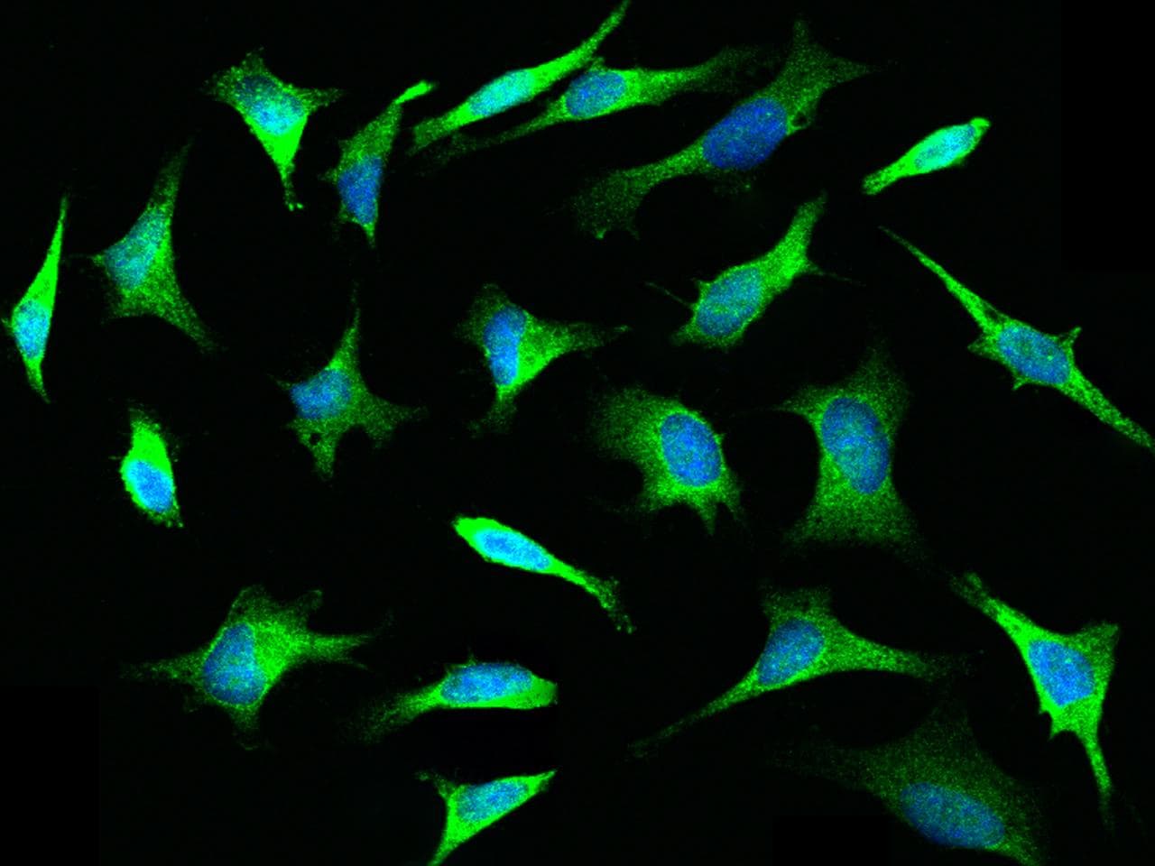 Polyclonal Rabbit anti-Human TLR3 Antibody (Preservative Free, IHC, IF)