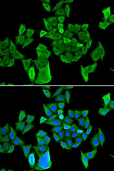 DIS / CCAR1 Antibody