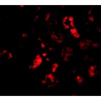IHC-plus™ BANF1 / BAF / BCRP1 Antibody