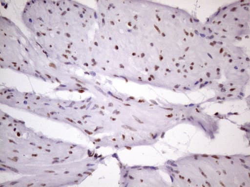 NUDT21 Antibody (aa2-227, clone OTI13H1)