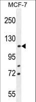 Polyclonal Rabbit anti-Human BTF / BCLAF1 Antibody (aa658-687, IHC, WB)