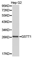 GSTT1 Antibody