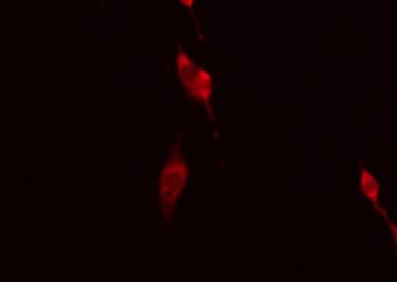 GIMAP5 Antibody