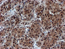 PSMA6 Antibody (clone OTI5H3)