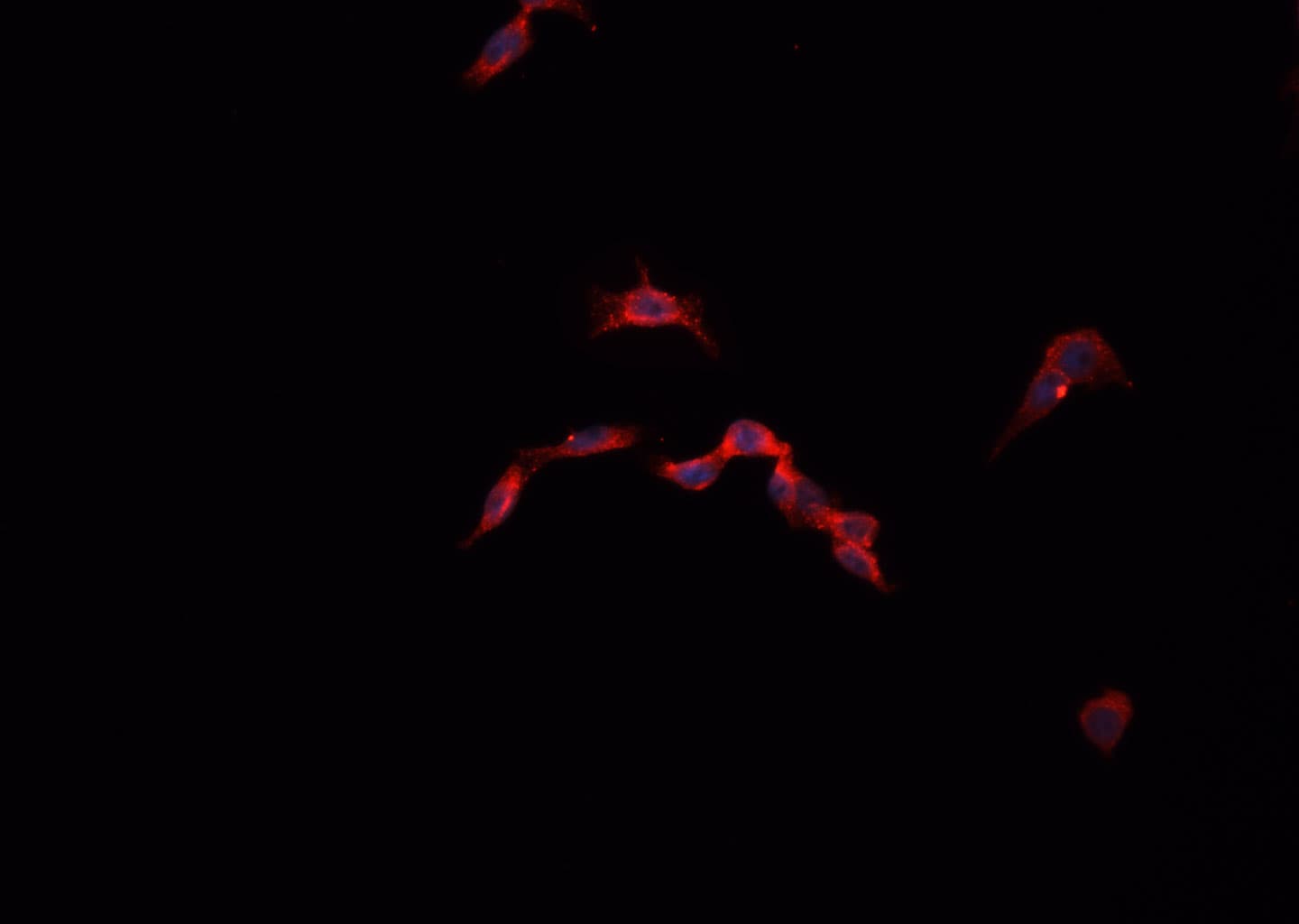 Polyclonal Rabbit anti-Human CYSLTR1 / CYSLT1 Antibody (IF, WB)