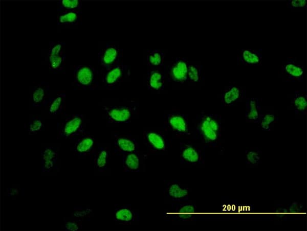 Monoclonal Mouse anti-Human TLK2 Antibody (clone 2G7, IHC, IF, WB)