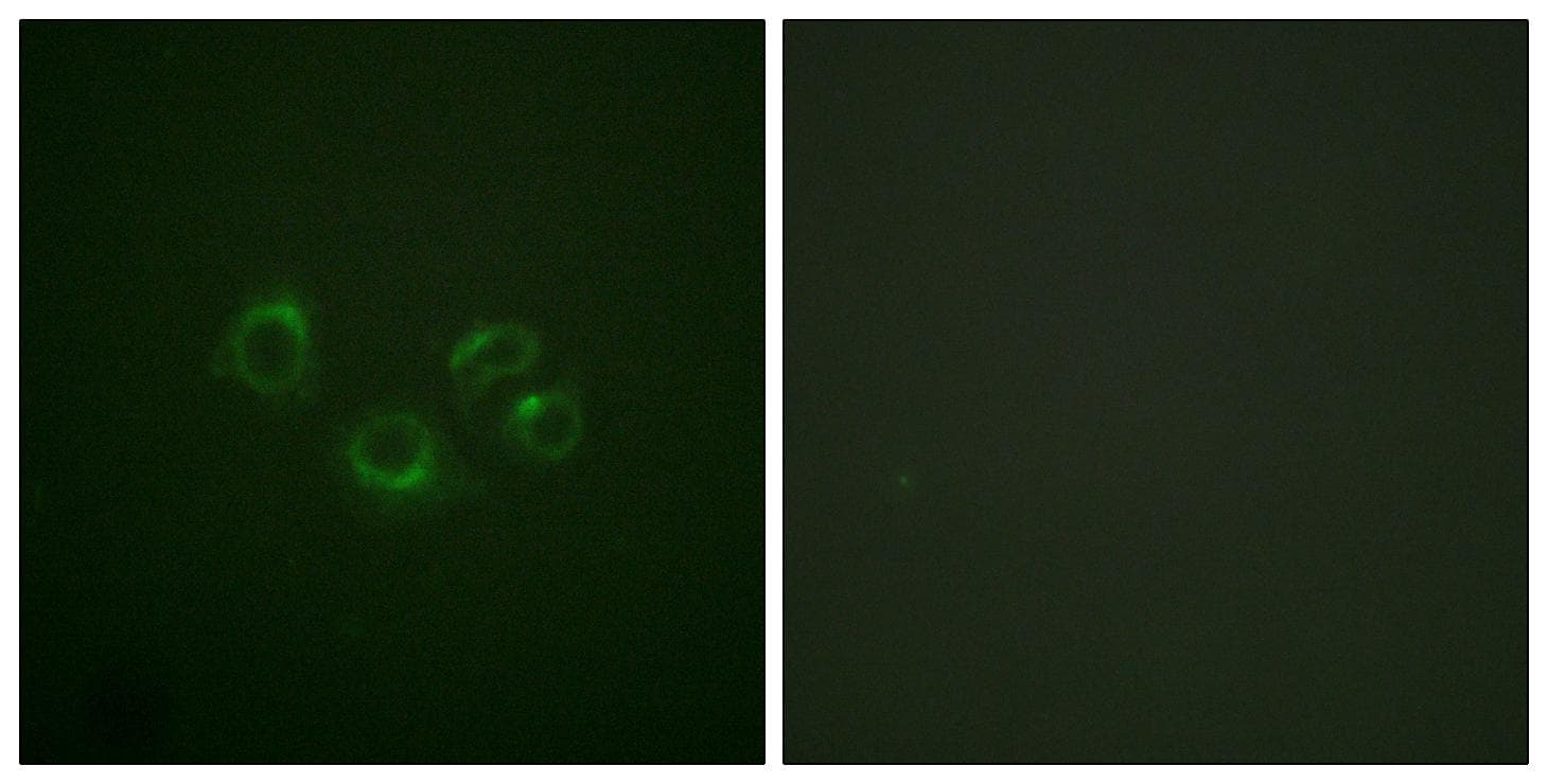 EPH Receptor A2+A3+A4 Antibody (p588/596)
