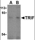 IHC-plus™ Polyclonal Rabbit anti-Human TICAM1 / TRIF Antibody (C-Terminus, IHC, WB)