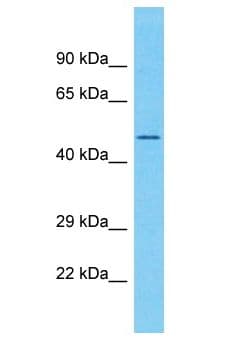 Polyclonal Rabbit anti-Human CCDC85C Antibody (aa354-403, WB)