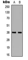 TBP / GTF2D Antibody (Internal)