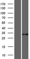 PSMB11 / BETA5T Protein (Over-Expression Lysate Myc-DDK (Flag))