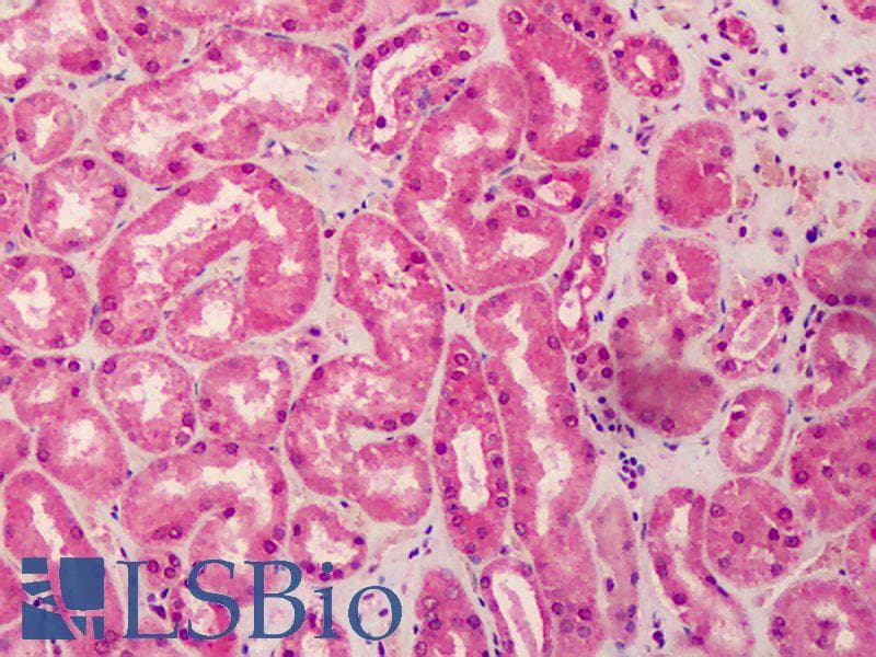 IHC-plus™ CASP6 / Caspase 6 Antibody