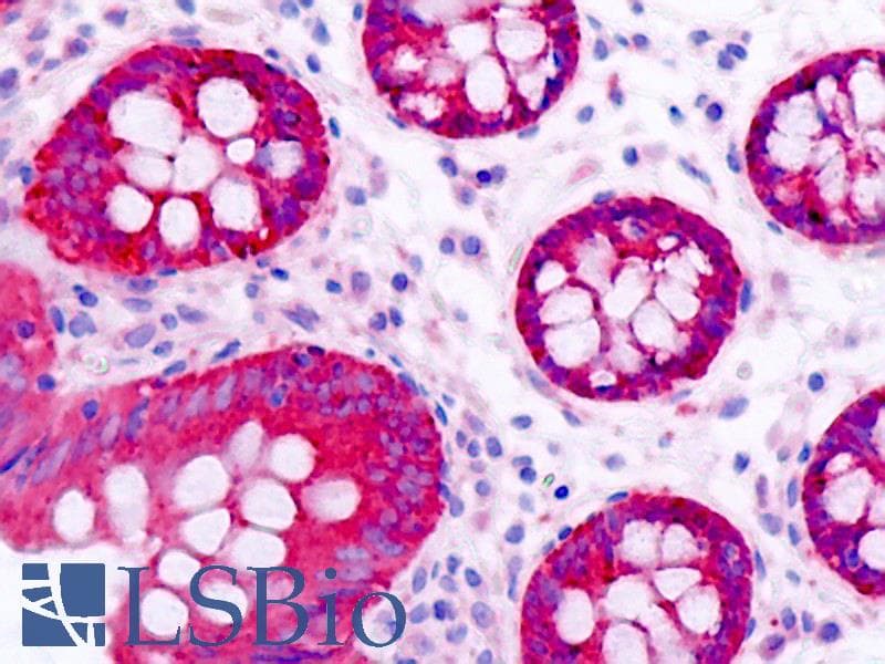 IHC-plus™ BAIAP2L1 Antibody (aa111-160)