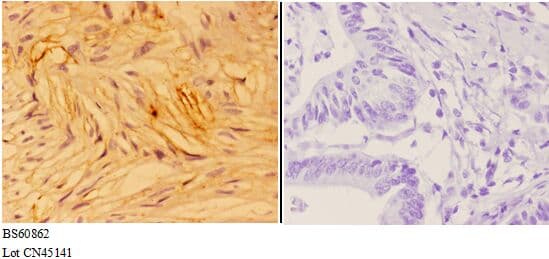 ANXA7 / Annexin VII / SNX Antibody