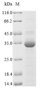 Thrombin-like enzyme (Agkistrodon contortrix) Protein (Recombinant 10His, N-terminus + Myc, C-terminus)