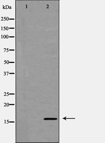 EIF5A Antibody