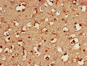 BAIAP2 / IRSP53 Antibody
