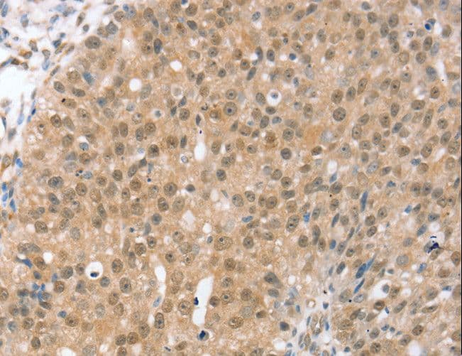 Polyclonal Rabbit anti-Human TRIM35 Antibody (IHC, WB)